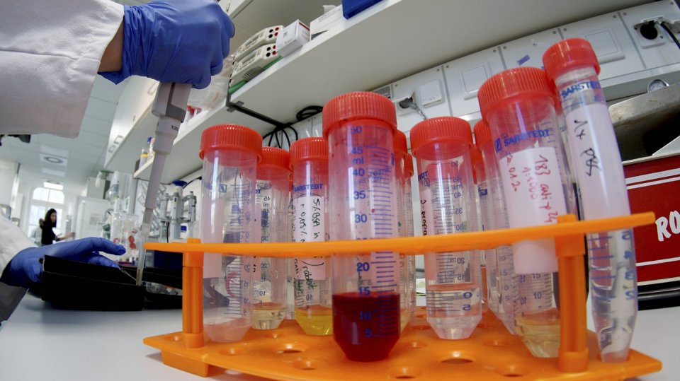 Berlínská nemocnice Charite zkoumá koronavirus